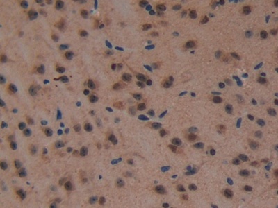 Mouse Brain Tissue (LAMa1)