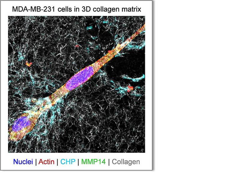 がん細胞によるコラーゲンの代謝回転の可視化